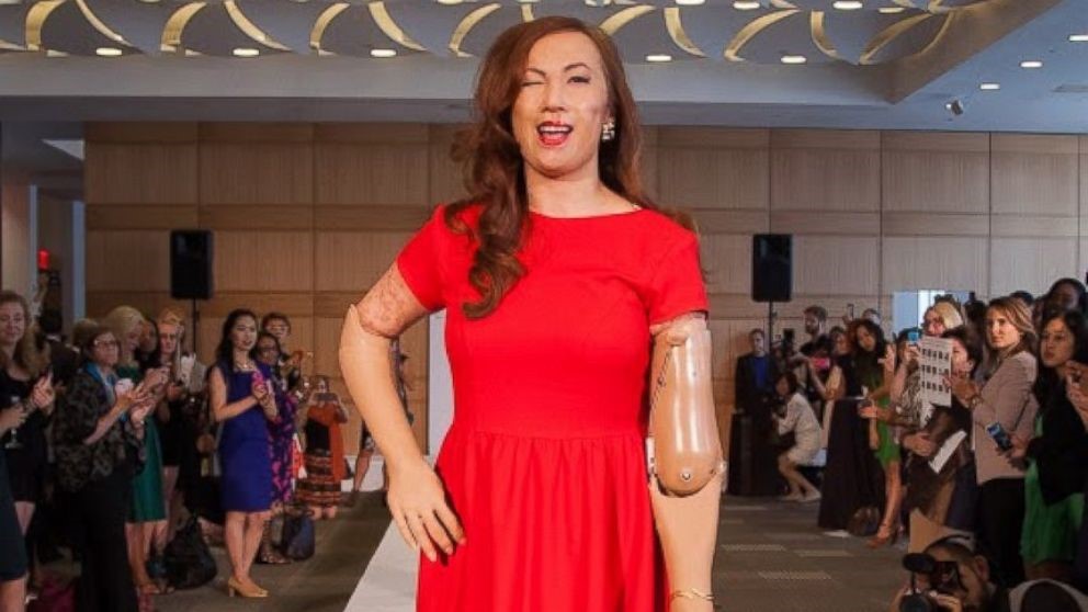 Karen Crespo made headlines in 2014 as the first-ever quadruple amputee to walk at New York Fashion Week.